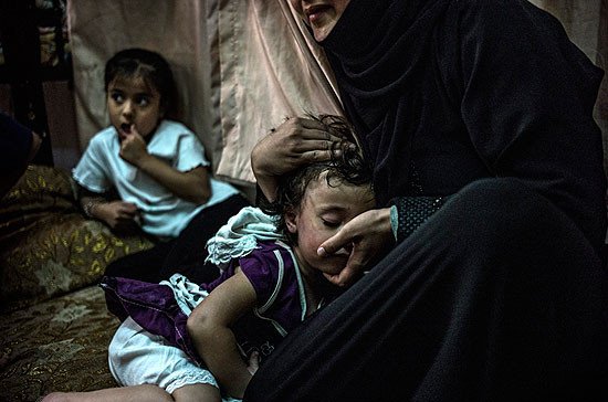 Una madre siria refugiada que vive en Amán, Jordania, muestra las heridas en el rostro de su hija pequeña después de que la golpeara un vecino. ACNUR/O. Laban-Mattei.
