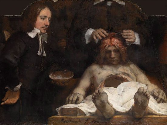 Rembrandt. La lección de Anatomía del dr. Joan Deyman, 1656. © Amsterdam Museum (SA 7394)