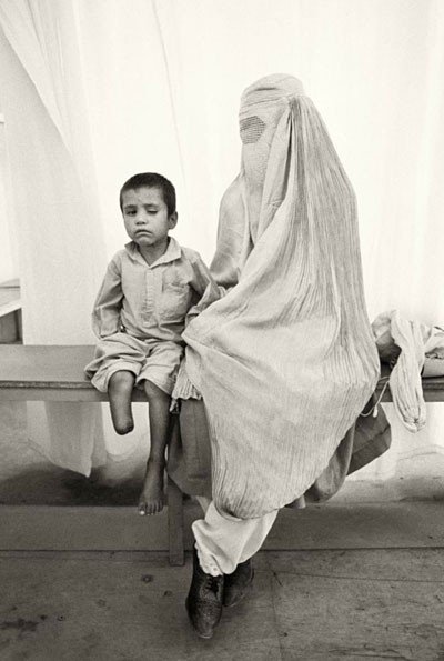  Niño mutilado y madre burka, de Gervasio Sánchez. Afganistán, 1996.